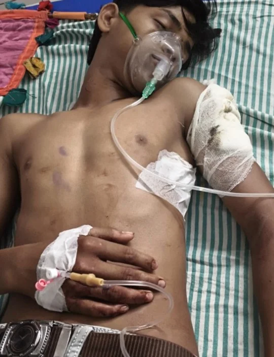 तेज रफ्तार बाइक विवाद की रंजिश में युवक पर चाकू से हमला, चार आरोपी हिरासत म