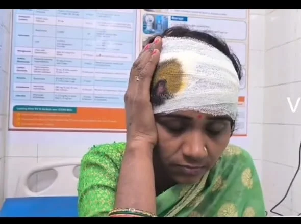 जौनपुर में विवाद के बाद मारपीट, महिला समेत तीन घायल; पुलिस जांच में जुटी